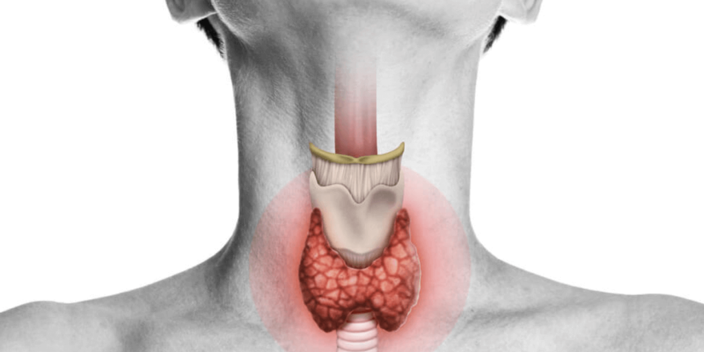 Thyroid